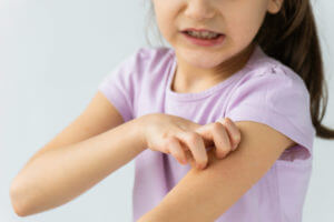 little girl scratching her arm full of eczema