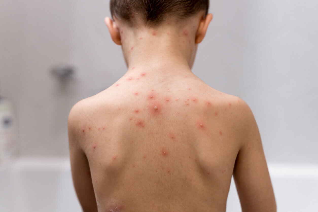 pediatric rash picture Pediatric Dermatology: Assessing Viral Rashes | Happy Skin
