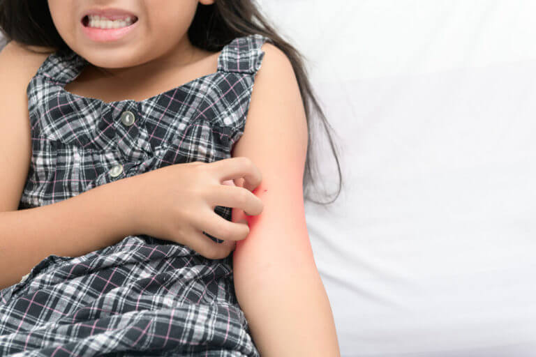 A girl is scratching her skin due to an itch caused by an eczema flare-up.